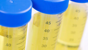 ¿Cuánto tiempo, tras el consumo, pueden ser detectadas las drogas en un análisis de orina?