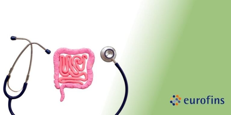 Qué es SIBO: definición, causas, síntomas y cómo tratar el sobrecrecimiento bacteriano intestinal